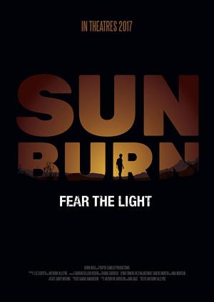 Sunburn