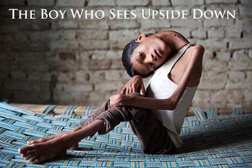The Boy Who Sees Upside Down