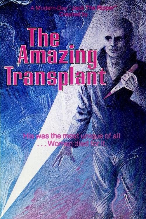 The Amazing Transplant